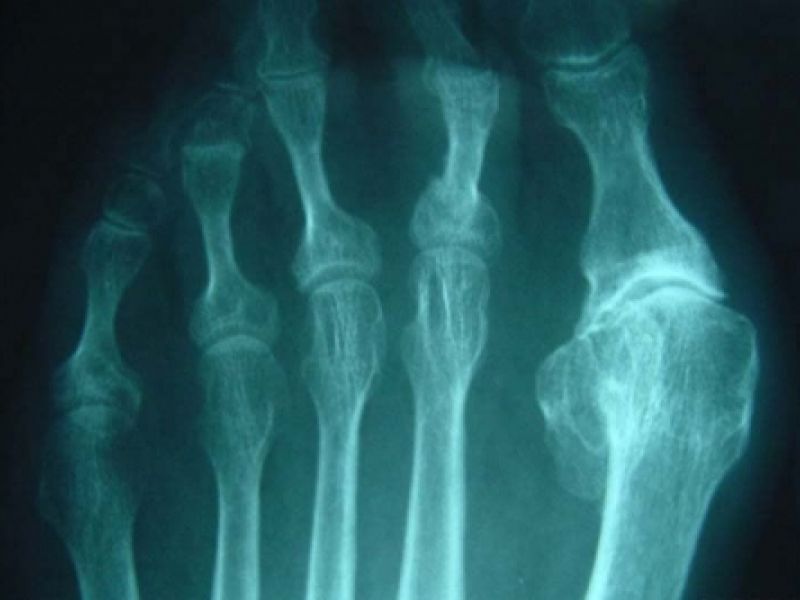 Radiología